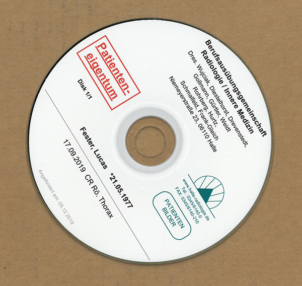 Thorax-(Lunge)-Röntgen-CD