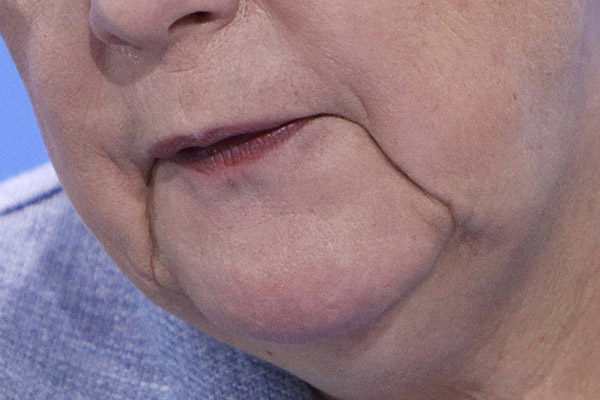 Angela Merkel's Depressionsgrübchen
