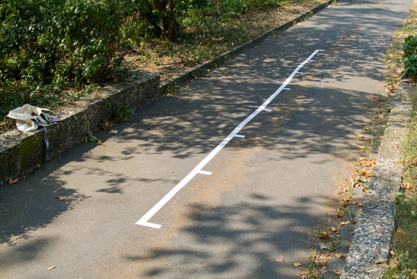 … 7 meters … my intestine …